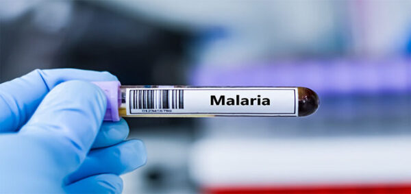 Peneliti Ciptakan Blueprint Imun, Harapan Baru Lawan Malaria